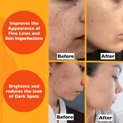 Radiant Glow Anti-Aging Serum™