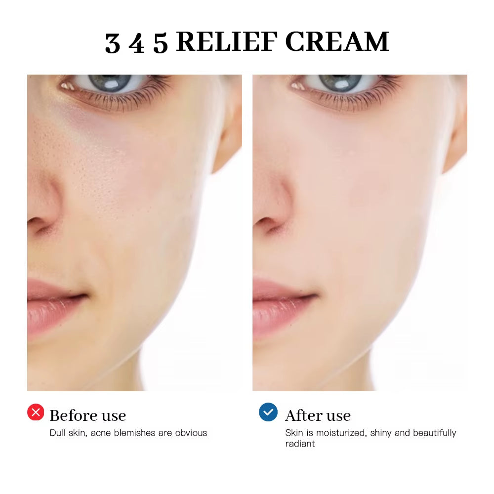 345 Relief Cream Comprehensive Solution to Skin Problems Anti-Sugar and Antioxidant Brightening Skin Improving Acne Marks Moistu